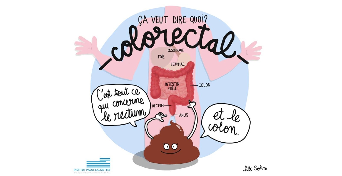 Cancer Colorectal Chez La Femme Sympt Mes Qui Doivent Alerter