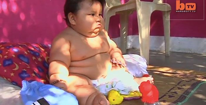 Un Bebe Obese Des La Naissance